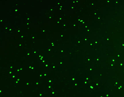 SomaticScan - Somatic Cell Counter & Mastitis Detection